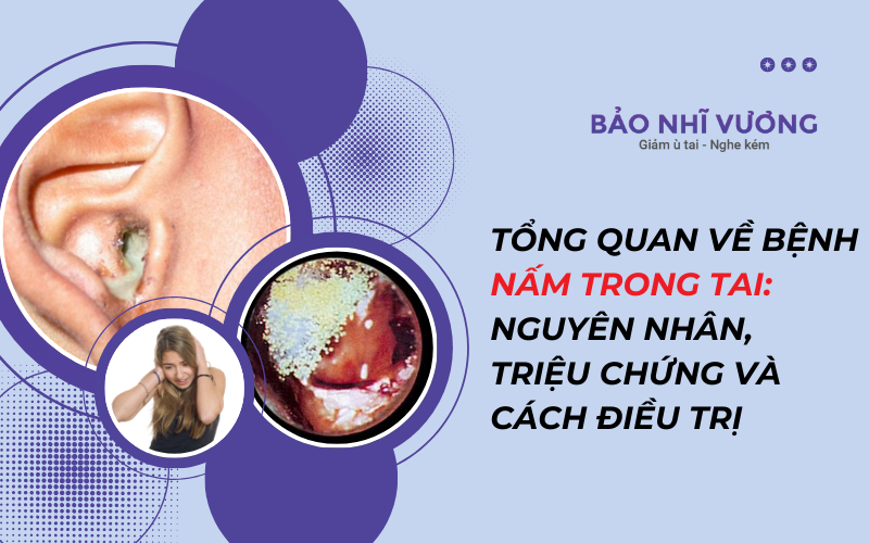 Tổng quan về bệnh nấm trong tai: Nguyên nhân, triệu chứng và cách điều trị!