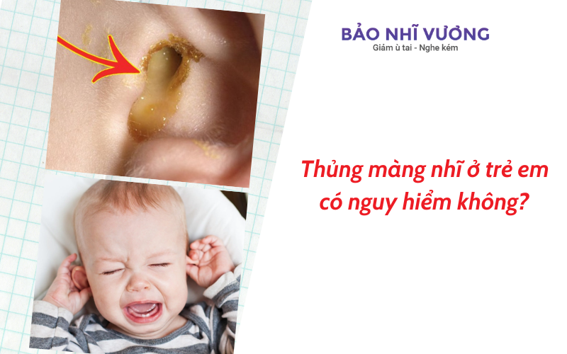 Thủng màng nhĩ ở trẻ em có nguy hiểm không?