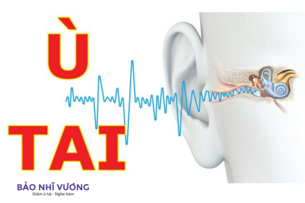 liệu pháp âm thanh cải thiện ù tai