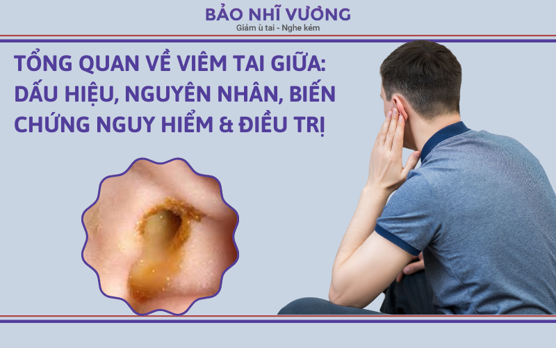 Tổng quan về viêm tai giữa: Dấu hiệu, nguyên nhân, biến chứng nguy hiểm và cách điều trị