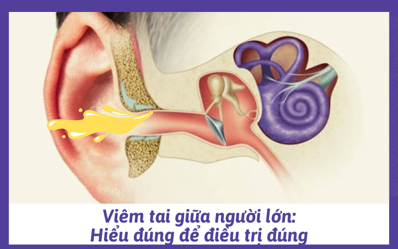 Viêm tai giữa người lớn: Hiểu đúng để điều trị đúng