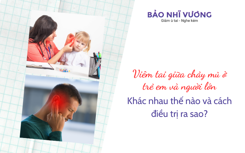 Viêm tai giữa chảy mủ ở trẻ em và người lớn: Khác nhau thế nào và cách điều trị ra sao?