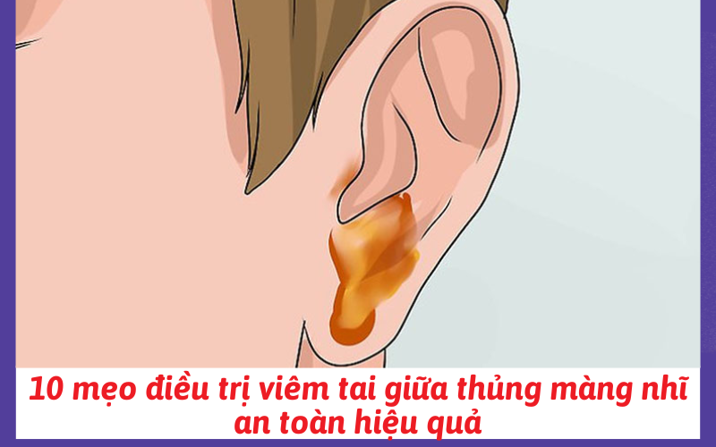 10 mẹo điều trị viêm tai giữa thủng màng nhĩ an toàn hiệu quả